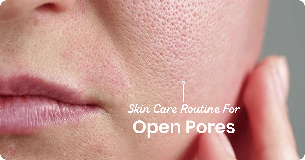 Close-up of facial skin highlighting open pores with text about a skincare routine for open pores.